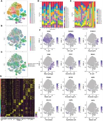Heme oxygenase-1 determines the cell fate of ferroptotic death of alveolar macrophages in COPD